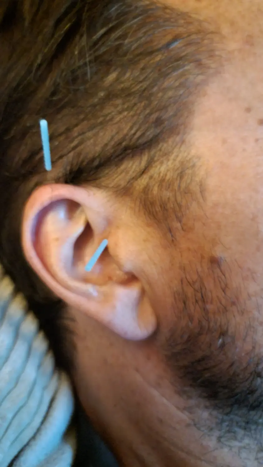 Orthopädie , Unfallchirurgie , Diagnostik & Therapie , Manuelle Medizin , Osteopathie , Akupunktur / Naturheilverfahren , PRP- / Eigenplasma-Therapie , Bewegungsapparat , Dr.Stegmaier , Neubiberg